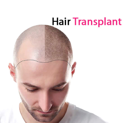 Hair Transplant Course